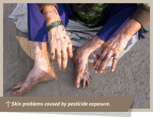helth effects of pesticide pollution